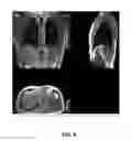 Fig. 09 - Dual flip angle multi-echo ultra-short echo time (DUFA-MUTE) magnetic resonance imaging (MRI) systems and methods