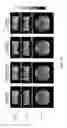 Fig. 14 - Magnetic resonance imaging with undersampling