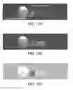 Fig. 08 - Systems and methods for phase-sensitive inversion recovery MR imaging with reduced sensitivity to cardiac motion