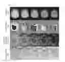 Fig. 01 - Methods and apparatuses for phase unwrapping