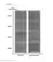 Fig. 04 - PROCESS FOR IMPROVING THE CRITICAL DIMENSION UNIFORMITY OF ORDERED FILMS OF BLOCK COPOLYMERS