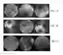 Fig. 02 - VISUAL REPRESENTATION LEARNING FOR BRAIN TUMOR CLASSIFICATION