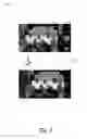 Fig. 06 - Automatic capture and refinement of a digital image of a group of people without user intervention