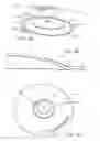 Fig. 05 - Electronic cymbal assembly and components thereof