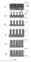 Fig. 08 - Device and method of manufacturing high aspect ratio structures