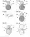 Fig. 06 - Secondary battery and electronic device