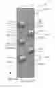 Fig. 01 - Methods and systems for controllably moving one or more moveable stages in a displacement device