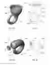 Fig. 02 - Loudspeaker and method of its manufacture