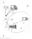 Fig. 02 - Narrowband-physical random access channel techniques