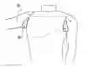 Fig. 01 - Golf garment with shoulder joint support