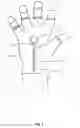 Fig. 03 - GLOVE WITH MAGNETIC GRIP AID