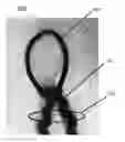 Fig. 01 - Hair extension device and method