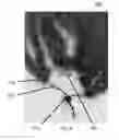 Fig. 05 - Hair extension device and method