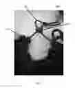 Fig. 06 - Hair extension device and method
