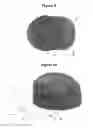 Fig. 06 - A Hat with a Removable Brim