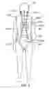 Fig. 03 - System and method for head and spine immobilization and protection