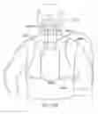 Fig. 30 - System and method for head and spine immobilization and protection