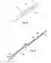 Fig. 28 - Surgical access system and related methods