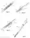 Fig. 30 - Surgical access system and related methods