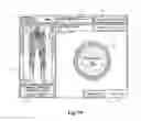 Fig. 33 - Surgical access system and related methods