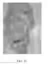 Fig. 43 - Method and apparatus for biological evaluation