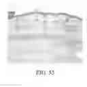 Fig. 45 - Method and apparatus for biological evaluation