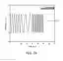 Fig. 07 - Method and apparatus for correction of non-invasive blood glucose measurement
