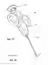Fig. 02 - VACUUM ASSISTED BIOPSY DEVICE