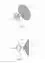 Fig. 02 - METHOD OF IMPLANTING AN ADJUSTABLE OCCLUSION DEVICE