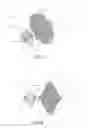 Fig. 04 - METHOD OF IMPLANTING AN ADJUSTABLE OCCLUSION DEVICE