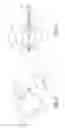 Fig. 06 - METHOD OF IMPLANTING AN ADJUSTABLE OCCLUSION DEVICE