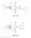 Fig. 09 - METHOD OF IMPLANTING AN ADJUSTABLE OCCLUSION DEVICE