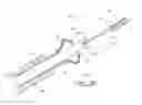 Fig. 13 - METHOD OF IMPLANTING AN ADJUSTABLE OCCLUSION DEVICE