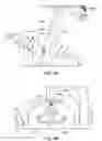Fig. 06 - System for Approaching the Spine Laterally and Retracting Tissue in an Anterior to Posterior Direction
