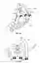 Fig. 09 - System for Approaching the Spine Laterally and Retracting Tissue in an Anterior to Posterior Direction