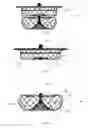 Fig. 02 - Left atrial appendage occluder