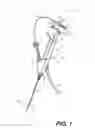 Fig. 02 - Medical device handles and related methods