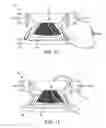 Fig. 08 - High-pressure water debridement system