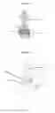 Fig. 02 - Circumcision device