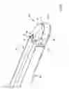 Fig. 07 - Device for severing and removing tissue parts