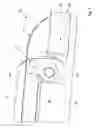 Fig. 08 - Device for severing and removing tissue parts