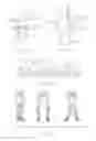 Fig. 02 - Method and apparatus for altering biomechanics of articular joints