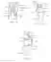 Fig. 07 - Method and apparatus for altering biomechanics of articular joints
