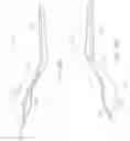 Fig. 26 - Method and apparatus for altering biomechanics of articular joints