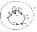 Fig. 01 - CRANIAL PLATING AND BUR HOLE COVER SYSTEM AND METHODS OF USE