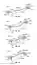 Fig. 13 - CRANIAL PLATING AND BUR HOLE COVER SYSTEM AND METHODS OF USE
