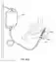 Fig. 08 - METHOD AND DEVICE FOR DELIVERING MEDICINE TO BONE