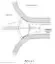 Fig. 04 - Contrast agent to assess quality of occlusion through impedance measurement
