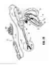 Fig. 03 - Vessel sealer and divider