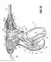 Fig. 22 - Vessel sealer and divider